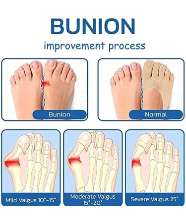 Orthopedic Bunion Relief Socks for Women and Men - Projoint Antibunion Health Socks - Toe Compression and Alignment - 5 Pairs Beige - Buy Online on GoSupps.com
