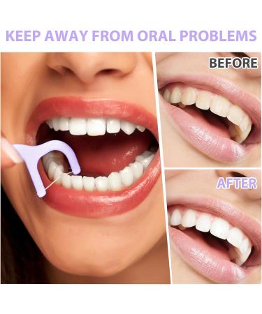 Portable Tooth Pocket Lila - 2 pcs Automatic Dental Floss Organizer & Travel Storage Box with 10 Refillable Picks | Perfect for Dinner Dates - Buy Online on GoSupps.com