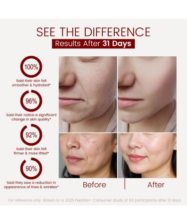 Moisturizer Face Cream with Hyaluronic Acid, 95% Snail Secretion Filtrate Anti Wrinkle Cream for Skin Repair & Tighten, Repair Damage, Promote Regeneration, Intensive Moisturizing, 4.586oz (Snail_2) - Buy Online on GoSupps.com
