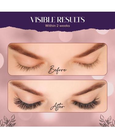 Eyelash Growth Serum - Best Lash Serum with Eyeliner for Thicker Stronger & Longer Lashes - Paraben-Free - 7 ml - Buy Online on GoSupps.com