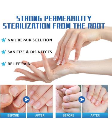 Keratin Nail Growth Oil Nail Strengthener for Damaged Nails - Buy Online on GoSupps.com