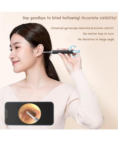 Nautig Ear Wax Removal Camera Kit - Wireless Ear Cleaner with HD Visual Inspection, Multifunctional Ear Scoop and LED Light (Color A) - Buy Online on GoSupps.com