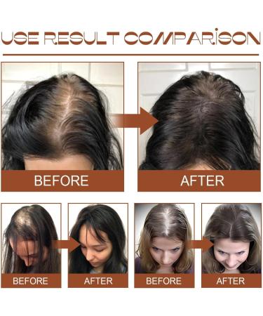 KiJalyelu Batana Oil for Hair Growth and Nourishment Natural Batana Oil for Hair Growth Healthier Thicker Hair Promotes Hair Strength Prevent Hair Loss - 120ml (2PC) - Buy Online on GoSupps.com