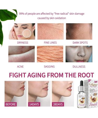 Snail Collagen Serum Snail Mucin Repair Serums Hyaluronic Acid Snail Secretion Filtrate Face Serum Natural Pure Snail Anti Aging Serum For Face Skincare Serum Cruelty Free35ml - Buy Online on GoSupps.com