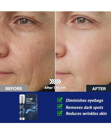 6 in 1 Face Cream for Men Anti Aging Men s Moisturizer with Collagen Hyaluronic Acid and Shea Butter Daily Skin Care Reduce the Look of Eye Bags Dark Circles and Puffiness 1.76 fl oz (1) - Buy Online on GoSupps.com