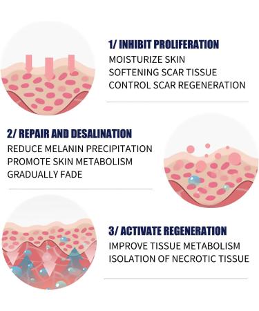Effective Scar Removal Cream for Adults Safe Day & Night Protection Fades & Repairs Scars - Buy Online on GoSupps.com