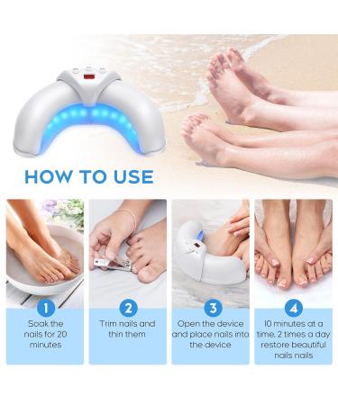 Nail Fungus Light Device for Toenails & Fingernails - Effective Nail Repair Solution for Damaged & Discolored Nails - Home Use - White - Buy Online on GoSupps.com