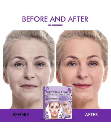 VERYCOZY Forehead Wrinkle Patches - 100 PCS Face Tape for Smooth Fine Lines & Wrinkles | Invisible Silicone Patches for Overnight Reduction on Forehead, Eyes, Around Mouth & Upper Lip - Buy Online on GoSupps.com