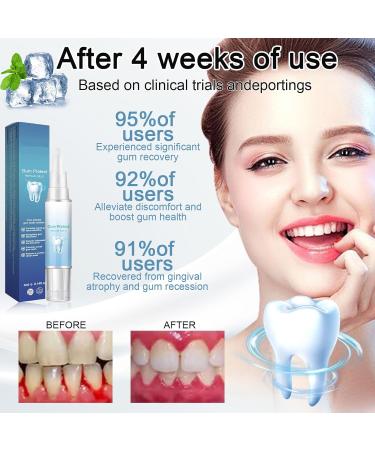 Gum Shield Therapy Gel Gum Gel Gum Shield Therapy Gel and Whitening Instant Teeth Whitening Essence Pen Deeply Cleaning Gums Enhances Overall Gum Health(3PCS) - Buy Online on GoSupps.com