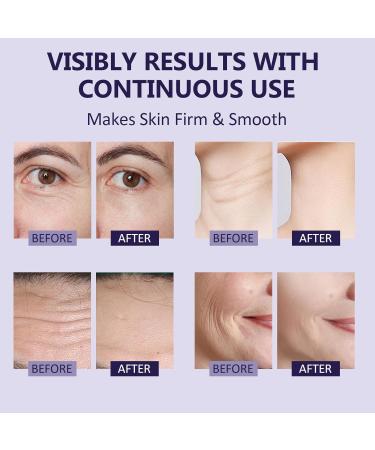 Korean Face Moisturizer - Anti-Wrinkle Cream with Collagen & Hyaluronic Acid for All Skin Types | Anti-Aging Skin Care for Men & Women - 1.69 oz - Buy Online on GoSupps.com