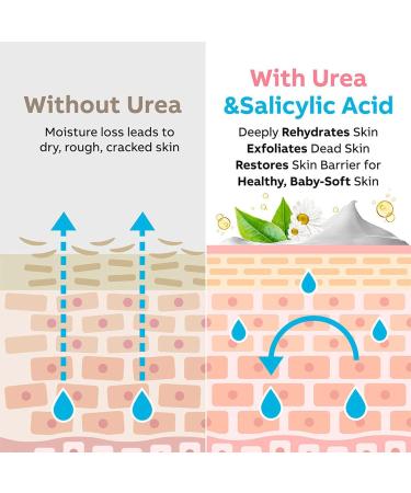 Urea Cream Urea 42% Foot Cream Ultra Moisturizing Heel Balm For Callus Removal and Soften Cracked Heel Repair Cream for Dry Skin Urea Lotion for Feet Hand & Body Maximum Strength - Buy Online on GoSupps.com