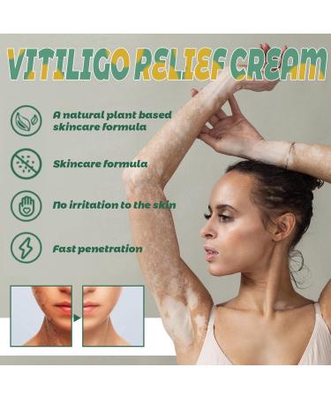  Wootapson 2PC Vitiligo Care Cream Skin Therapy Cream Lotion for vitiligo moisturizing and nourishing helps improve skin pigmentation and uneven tone suitable for all skin types - Buy Online on GoSupps.com