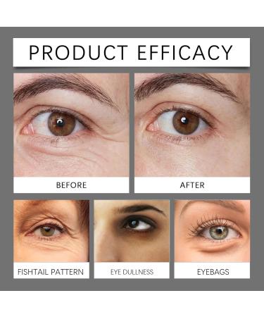 Retinol Eye Cream Instant Iift Plus Dark Circles Instant Firm Eye Tightener Under Eye Bags And Wrinkles Instant Eye Lift. Instantly Removes Bags Dark Circles Firming Delicate skin (2) - Buy Online on GoSupps.com