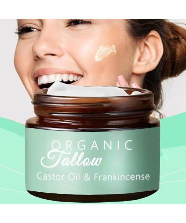 Beef Tallow with Frankincense OilCastor oil Beef Tallow MoisturizeWhipped Tallow Balm With Castor Oil Beef Tallow Skin Care Frankincense Oil Face Cream for All Skin Types141 ml - Buy Online on GoSupps.com