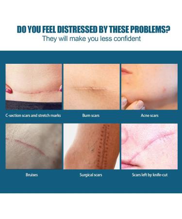 Scar Repairing Serum 30ml - Gentle Scar Removal for All Skin Types - Buy Online on GoSupps.com