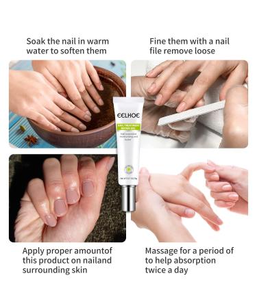 Efero 2PCs Nail Treatment Repair Gel Set - Nail Repair Cream & Essence for Healthy, Beautiful Nails - Toe and Toenail Care Solution - Buy Online on GoSupps.com