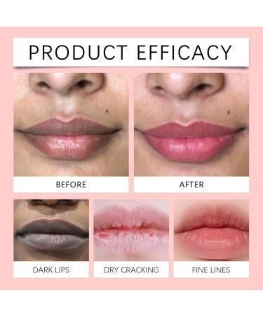 Winter Lip Balm - Natural Plant Extracts 10g Moisturizing Balm for Dry Lips for Women | for Wife Girlfriend Friends Sisters Dates Travel Gatherings Outings - Buy Online on GoSupps.com