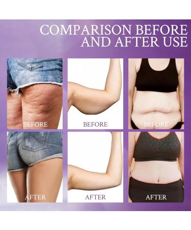 Lift & Firm Firming Lotion Body Cream Lift and Firm Firming Lotion Arm Cream Acts on wrinkles and sagging by making the skin firmer - Buy Online on GoSupps.com