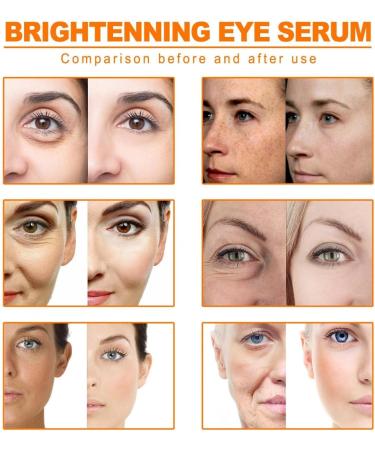 Anshka Acanthoclear Therapy Spray Acanthosis Nigricans Therapy Spray Dark Spot Remover Lighten Body Black Skin Permanent Whitening 2 pieces - Buy Online on GoSupps.com