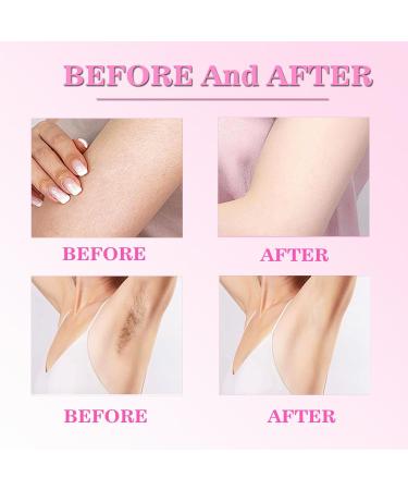 Cyperus Rotundus Oil for Hair Removal Natural Moisturizing & Soothing Gentle on All Skin Types 2 Fl Oz - Buy Online on GoSupps.com