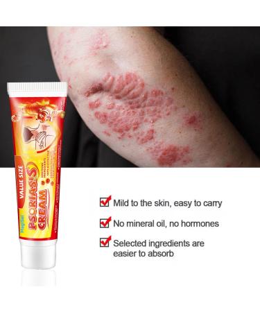  MagiSel Anti-itch ointment skin cream soothing skin cream for itching and psoriasis natural care formula cares for and soothes the skin suitable for skincare - Buy Online on GoSupps.com