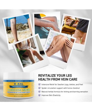 Varicose Veins Treatment Cream - Intensive Relief for Swollen Legs & Feet | Horse Chestnut Formula for Ages 50 - Buy Online on GoSupps.com