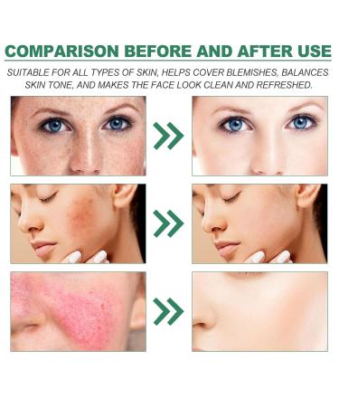 Color Correcting Cream - Hydrating Redness Treatment & After-Sun Care - Soothing Facial Cream for Spot Lightening (100g - Buy Online on GoSupps.com