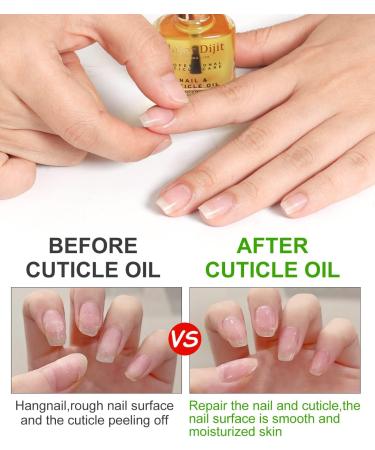 DouborQ Nail Dehydrator and Nail Primer with Cuticle Oil Set Natural Nail Prep Dehydrate and Acid-Free Primer for Gel Nail Polish Air Dry Superior Bonding Primer for Acrylic Powder - Buy Online on GoSupps.com