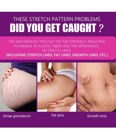 Cr me contre les Vergetures 10 Pi ces 0 4 Oz Cr me de R paration Hydratante Douce contre les Vergetures pour la Maison - Buy Online on GoSupps.com