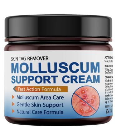 NateNatenight Molluscum Support Treatment Molluscum Support Cream All Natural Support Cream for Molluscum Rash 30g