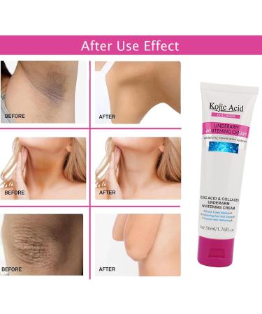 Underarm Skin Cream - Kojic Acid Underarm Product - Skin Cream - Armpit Bleaching Cream - Body Cream for Dark Skin Knee Reduce Odor - Buy Online on GoSupps.com