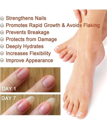 5Pcs 7 Days Nail Growth and Strengthening Serum Nail Serum Repair Essence Nail Growth & Strength Serum Toenail Nail For Repairing Damaged And Discolored Nails 20ml/0.67fl.oz - Buy Online on GoSupps.com