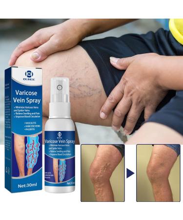 Xiyinli 30 ml Non-Toxic Varicose Vein Spray Relieves Swelling & Pain Improves Circulation - Buy Online on GoSupps.com