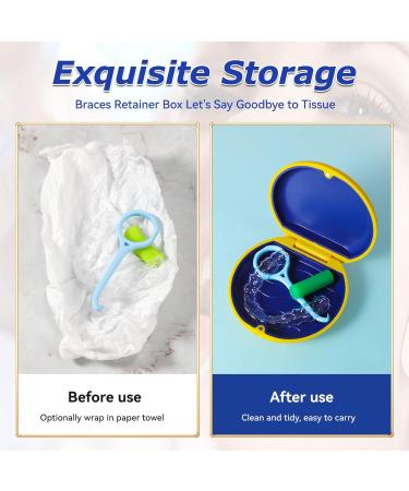 Annhua Retainer Case Denture Container Mouthguard Storage Box with Magnetic Closure False Teeth Container Denture Box Blue - Buy Online on GoSupps.com