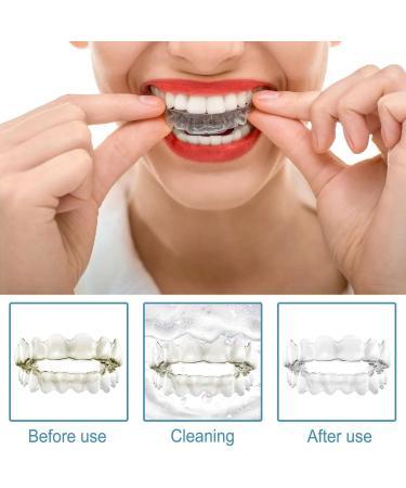 Effective Flot Removal Aligner - 2 Pieces 60 ml | Braces & Aligner Cleaner for Stain & Odor Removal - Buy Online on GoSupps.com