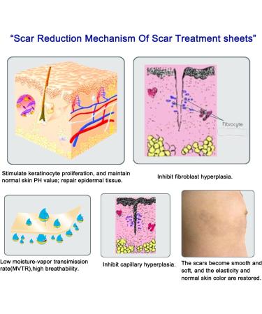 Longmed Silicone Scar Sheets for C-Section Keloid & Acne Scar Removal - 4 Pack 7 x 1.57 - Healing Strips & Sheets - Gel Tape & Cream Alternative - Buy Online on GoSupps.com