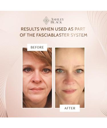 Single Claw FasciaBlaster by Ashley Black - Face Wrinkle Blaster - Buy Online on GoSupps.com