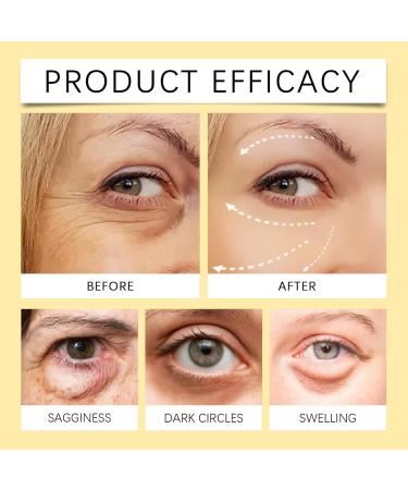 Temporary Instant Eye Tightener Cream: Instant Reduces Under-Eye Bags Instant Eye Lift. Instantly Removes Bags Dark Circles Puffiness Firming Delicate skin -30ml (2) - Buy Online on GoSupps.com
