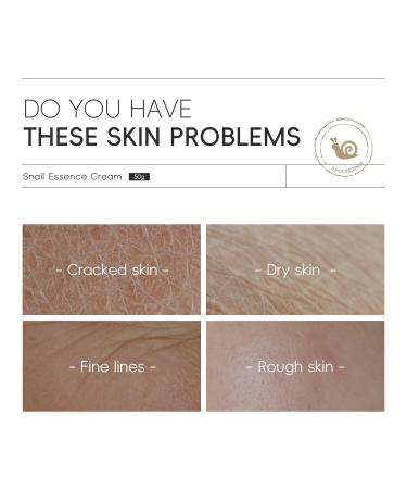 LAIKOU Korean Snail Essence Cream Face Moisturizer Moisturizer Face Cream Korean Moisturizer for All Skin Types Hydrating Firming Moisturizing Gentle 50g/1.76oz. - Buy Online on GoSupps.com