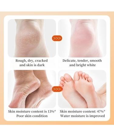 TBeautfave Foot Peel Mask 2 Pack Exfoliating Foot Mask Vitamin C Moisturizing Socks Feet Hard Skin Remover Feet Peeling Socks Whitening and Nourishing Foot Mask Foot Care Extra Long Foot Mask - Buy Online on GoSupps.com