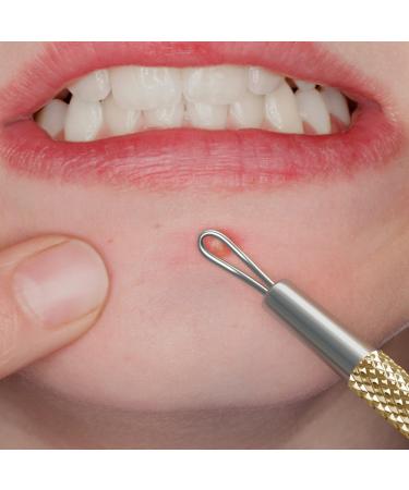 SC-11103-GLD Suvorna Whitehead Remover | Effective Pimple & Cyst Removal Tool for Clear Skin - Buy Online on GoSupps.com