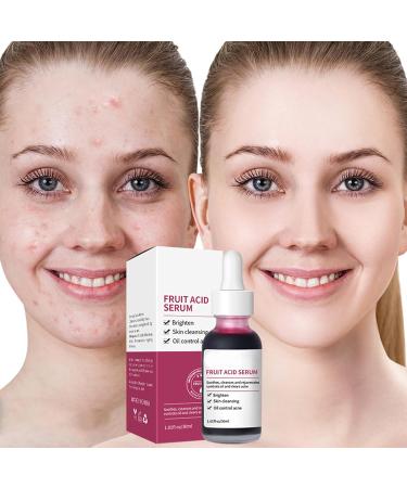 Pemarlis 2PCS Brightening Serum to Remove Dark Spots Oil Corrective Serum for Face and Body for Skin Treatment Against Acne and Pimple Marks - Buy Online on GoSupps.com