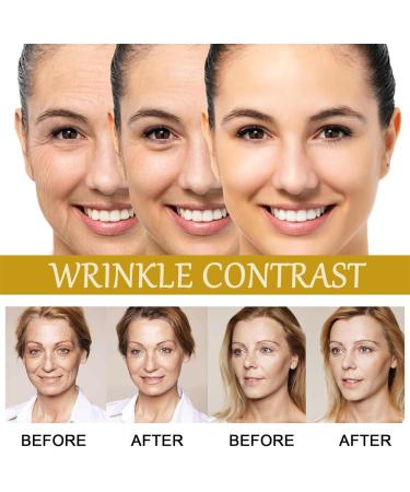 Vintesse Advanced Bee Venom Serum Vitesse Advanced Bee Venom Serum Vintesse Bee Venom Serum Vintesse Serum Honey Anti Aging Face Serum (2 Pcs) - Buy Online on GoSupps.com