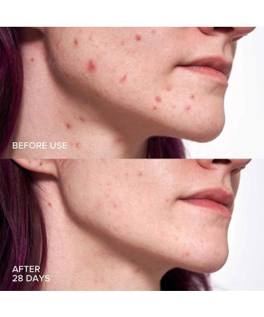 Alpyn Pore Perfecting Liquid Toner - 2% BHA Exfoliator for Minimizing Pores & Restoring Skin pH | 4 oz / 120 ml - International Shipping Available - Buy Online on GoSupps.com