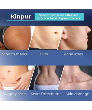 Advanced Scar Cream for Face and Body - Acne & Surgery Scar Treatment - Vitamin E, Silicone-Free Formula - All Skin Types - Buy Online on GoSupps.com