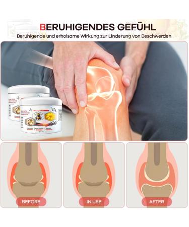 Todahof Bienenergift Ointment - 2 PCs Bee Cream for Pain Relief | Bienergiftsalbe for Arm Waist Legs & Feet - Buy Online on GoSupps.com