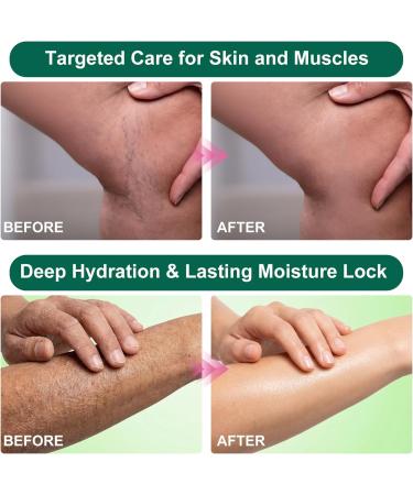 Miracle Balm Cr me De Massage Polyvalente Naturelle 50G Absorbant Rapidement Beurre Apaisant Pour La R cup ration Musculaire Soulagement Articulaire Et Hydratation Quotidienne-D tendue Confortable - Buy Online on GoSupps.com