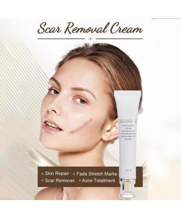 Fenayuu Cream against burn scars 30 g natural moisturizing skin care remove stretch marks for morning travel daily home daytime face body piercing bites - Buy Online on GoSupps.com