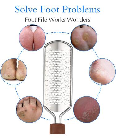Professional Pedicure Foot File - Stainless Steel Detachable Scrubber for Hard Skin Removal - Wet and Dry Feet Pedicure Rasp - Buy Online on GoSupps.com