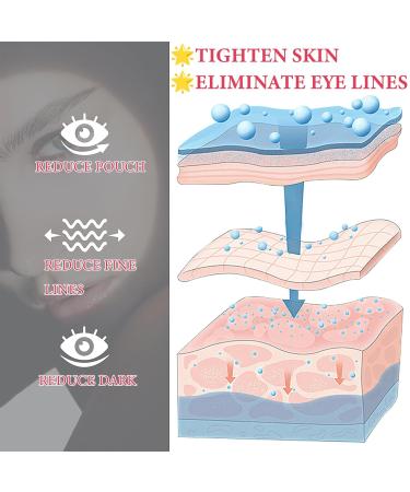Retinol Eye Cream for Dark Circles & Puffiness - Collagen & Hyaluronic Acid Under Eye Gel for Wrinkles Brightening & Hydration - Buy Online on GoSupps.com